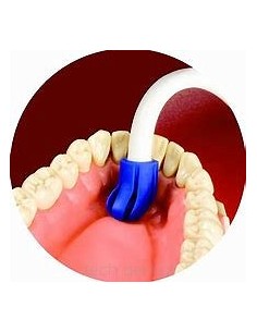 ZF.  Końcówki ślinociągu...
